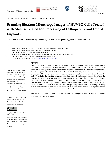 Digitalna vsebina dCOBISS (Scanning electron microscope images of HUVEC cells treated with materials used for processing of orthopaedic and dental implants [Elektronski vir])