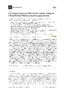 Digitalna vsebina dCOBISS (Functional imaging of the ocular fundus using an 8-band retinal multispectral imaging system [Elektronski vir])