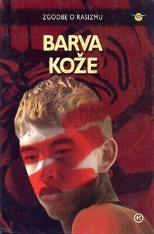 Barva kože : zgodbe o rasiz... (cover)